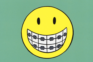 Smile, di Raina Telgemeier